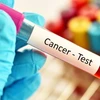 Australia đạt được bước đột phá trong việc sàng lọc ung thư ruột 