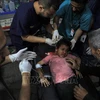 Điều trị cho em nhỏ bị thương trong xung đột Israel - Hamas ở thành phố Rafah, phía Nam Dải Gaza ngày 8/5/2024. (Ảnh: THX/TTXVN)