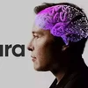 Neuralink, công ty sản xuất chip não của tỷ phú Elon Musk. (Nguồn: Neuralink)