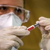 Nhân viên y tế chuẩn bị tiêm thử nghiệm vaccine phòng COVID-19 cho một tình nguyện viên tại Porto Alegre, Brazil, ngày 8/8/2020. (Ảnh: AFP/TTXVN)