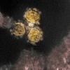 Hình ảnh quét qua kính hiển vi điện tử cho thấy virus SARS-COV-2 trên một mẫu bệnh phẩm của bệnh nhân COVID-19. (Ảnh: AFP/TTXVN)