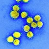 Hình ảnh virus SARS-COV-2 trên một mẫu bệnh phẩm của bệnh nhân COVID-19 qua kính hiển vi điện tử, ở Maryland (Mỹ). (Ảnh: AFP/TXVN)