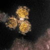 Hình ảnh qua kính hiển vi điện tử cho thấy virus SARS-CoV-2 trên một mẫu bệnh phẩm của bệnh nhân COVID-19, tại Viện Nghiên cứu Dị ứng và Bệnh Truyền nhiễm Quốc gia (Mỹ). (Ảnh: AFP/TTXVN)