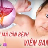 [Audio] Giải mã căn bệnh viêm gan bí ẩn khiến ba bệnh nhi tử vong