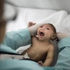 Một trẻ sơ sinh bị chứng đầu nhỏ do nhiễm virus Zika. (Nguồn: AP)