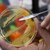 WHO công bố danh sách 12 siêu vi khuẩn đáng lo ngại nhất 