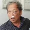 Nhà báo Hoàng Đình Chiểu, phóng viên Đài truyền hình Việt Nam bị hành hung khi đang tác nghiệp. (Nguồn: VTV.vn)