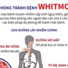 [Infographics] Những cách phòng tránh bệnh Whitmore nguy hiểm