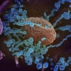 Hình ảnh quét qua kính hiển vi điện tử cho thấy virus SARS-CoV-2 (vật thể tròn màu xanh) nổi lên trên bề mặt tế bào bệnh nhân nhiễm COVID-19. (Nguồn: AFP/TTXVN)