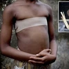 Một bé gái bị ép phẳng ngực bằng đá nóng. (Nguồn: QQ News)