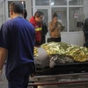 Chuyển một nạn nhân bị thương trong vụ cháy nổ tới chữa trị tại bệnh viện ở Bucharest ngày 31/10. (Nguồn: THX/TTXVN)