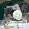 Pháp phát hiện vi khuẩn lạ gây tử vong ở trẻ sơ sinh