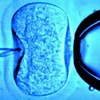 Tòa án Italy bỏ lệnh cấm dùng tinh trùng và trứng hiến tặng