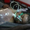 Trẻ em Syria được điều trị y tế do hít phải khí độc sau đợt không kích ở thị trấn Khan Sheikhun, tỉnh Idlib ngày 4/4. (Nguồn: AFP/TTXVN)