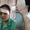 Cô gái 16 tuổi bị nhóm thanh niên cắt tai, đánh đập.. (Nguồn: Facebook Thông tin Chính phủ)