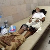 Bệnh nhân nhiễm tả điều trị tại một bệnh viện ở Sana’a. (Nguồn: AFP/TTXVN)