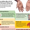 [Infographics] Nguy cơ nhiễm độc chì từ những thói quen hàng ngày