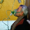 Một nạn nhân trong vụ tấn công, được cho là sử dụng vũ khí hóa học, được điều trị tại một bệnh viện ở Douma, Đông Ghouta, Syria ngày 22/1. (Nguồn: AFP/TTXVN)