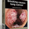 Mẫu bao thuốc lá đưa hình ảnh chân thực cảnh báo về tác hại của hút thuốc lá đối với sức khỏe con người. (Ảnh: AFP/TTXVN)