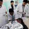 Trẻ em bị thương trong vụ tấn công được điều trị tại một trung tâm y tế ở Saada, Yemen ngày 9/8. (Ảnh: AFP/TTXVN)