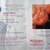 Khẩn trương xác minh trường hợp thai nhi 5,1kg tử vong tại Bình Định