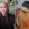 Bình Thuận: Bé trai nghi bị bạo hành sau khi tham dự 'khóa tu'