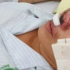Bệnh truyền nhiễm dễ gây tử vong Whitmore tái xuất hiện ở Việt Nam