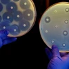 Nuôi cấy vi khuẩn thử nghiệm kháng sinh. (Nguồn: Science History Images/Alamy)