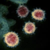 Hình ảnh virus SARS-CoV-2 được soi dưới kính hiển vi. (Ảnh: AFP/TTXVN)
