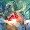 Thực hiện ghép tạng tại Bệnh viện Trung ương Huế. (Ảnh minh họa: Mai Trang/TTXVN)