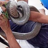 Anh Tâm vẫn giữ trong tay con rắn hổ mang khi được đưa đến cấp cứu tại bệnh viện. (Ảnh: TTXVN phát)