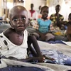 Trẻ em bị suy dinh dưỡng điều trị tại cơ sở y tế ở Aweil, Nam Sudan. (Ảnh: AFP/TTXVN)