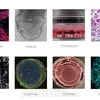 Các mô hình bệnh tật khác nhau sử dụng tế bào gốc đa năng cảm ứng. (Nguồn: Aving)