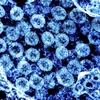 Hình ảnh từ kính hiển vi do Viện nghiên cứu bệnh truyền nhiễm và dị ứng quốc gia Mỹ cung cấp cho thấy virus SARS-CoV-2 trong mẫu bệnh phẩm của bệnh nhân mắc COVID-19. (Ảnh: AFP/TTXVN)