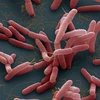 Vi khuẩn Burkholderia pseudomallei. (Nguồn: NPR)