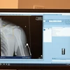 Trí tuệ nhân tạo được ứng dụng trong chụp phim X-quang. (Ảnh: AFP/TTXVN)