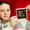 Quyết sinh con dù thai nhi chỉ có 1% cơ hội sống sót
