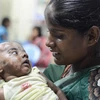 Ấn Độ: Một bé trai "đột nhiên bốc cháy" 4 lần trong 2 tháng