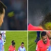 [Video] Cận cảnh màn ăn vạ thô thiển của tiền vệ Sergio Busquets