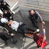 Một người bị thương trong các vụ đụng độ giữa Palestine và Israel. (Nguồn: countercurrents)