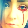 Cô gái 17 tuổi bị chảy máu mắt. (Nguồn: BBC)