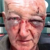 Cụ già bị đánh đập dã man. (Nguồn: manchestereveningnews.co.uk)