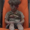 Cậu bé người Syria Omran. (Nguồn: news.com.au)