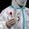 Vùng Lombardy xét nghiệm máu tìm người có kháng thể với virus SARS-CoV-2. (Nguồn: AFP)