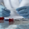 Mỹ siết chặt quy định với người nhập cảnh từ Uganda nhằm ngăn Ebola