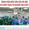 Bệnh viện đầu tiên của Hà Nội lấy và ghép tạng từ người cho chết não