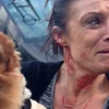 Một phụ nữ đổ máu để bảo vệ tính mạng chú chó cưng