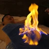 Kỳ bí phương pháp chữa bệnh bằng lửa tại Trung Quốc