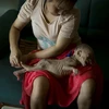 Cảm thương “Công chúa tí hon” mắc căn bệnh lạ ở Trung Quốc