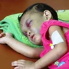 [Photo] Nỗi đau xót lòng vụ bé gái bị bạo hành ở Bình Dương